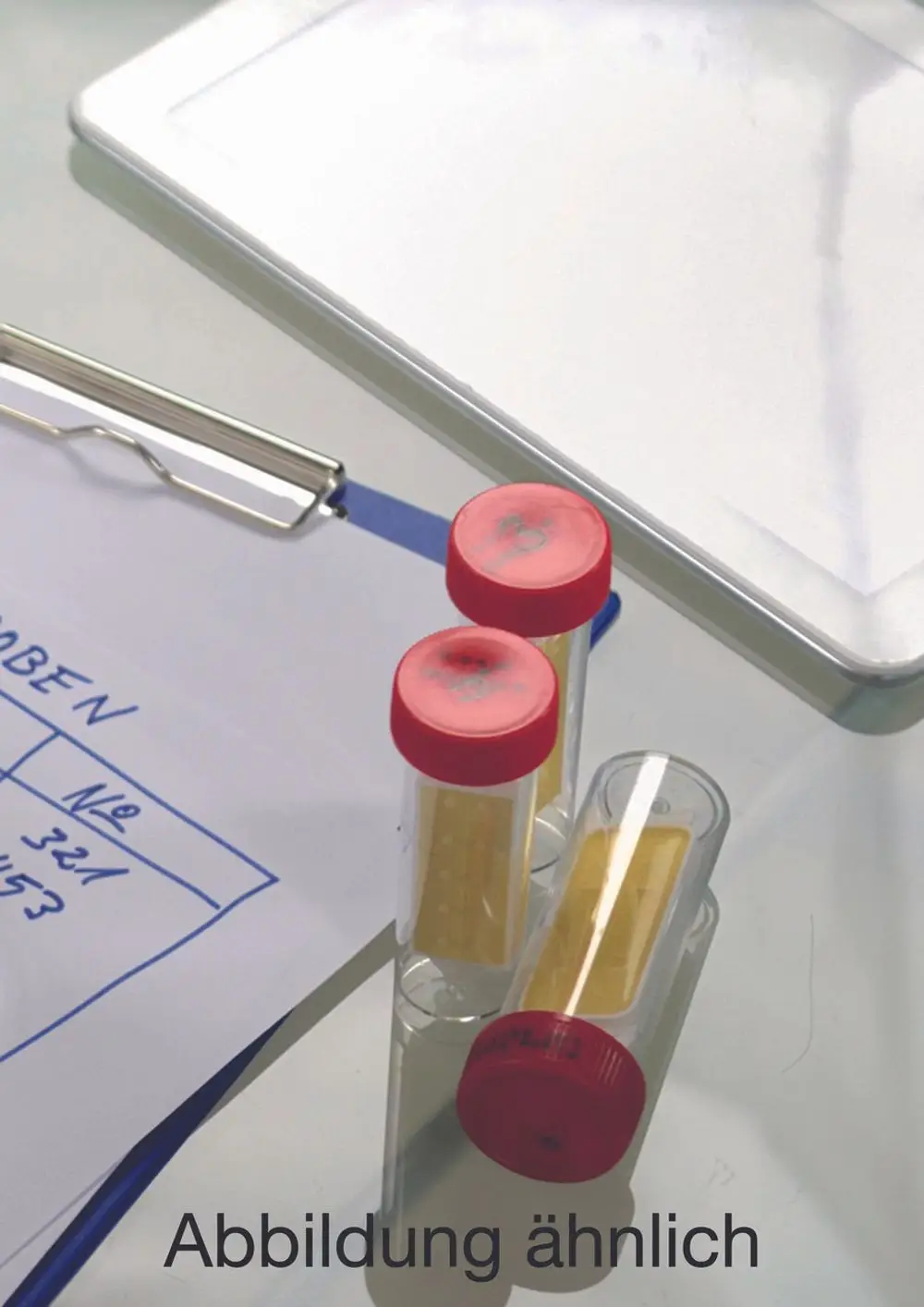 Drei Röhrchen mit roten Kappen und transparentem Gehäuse auf einem Tisch, umgeben von einem Clipboard mit handschriftlichen Notizen, typisches Laborumfeld von Judo.